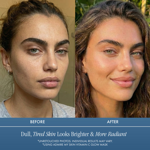 Vitamin C Facial Mask, Correct and Brighten Uneven Skin Tone