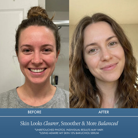 Bakuchiol Serum - Natural Retinol Alternative