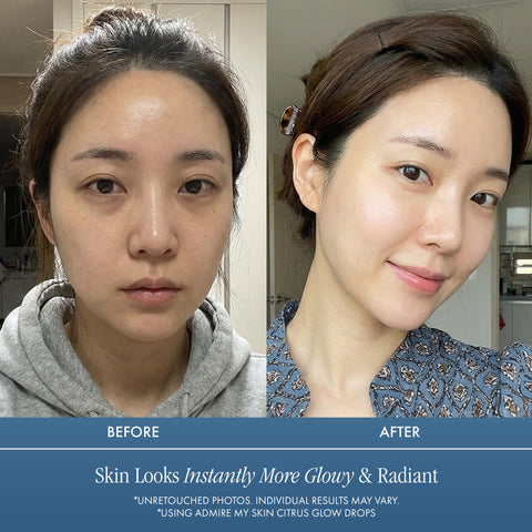 Vitamin C Oil — Citrus Glow Drops