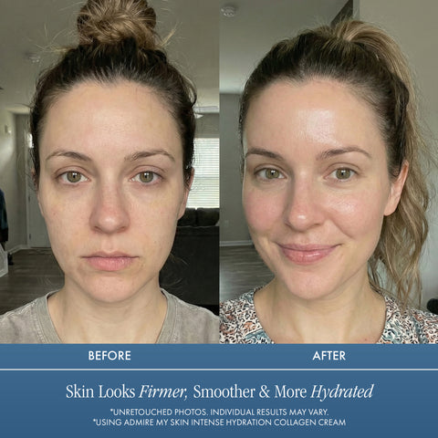 Collagen Face Cream - Intense Face Moisturizer