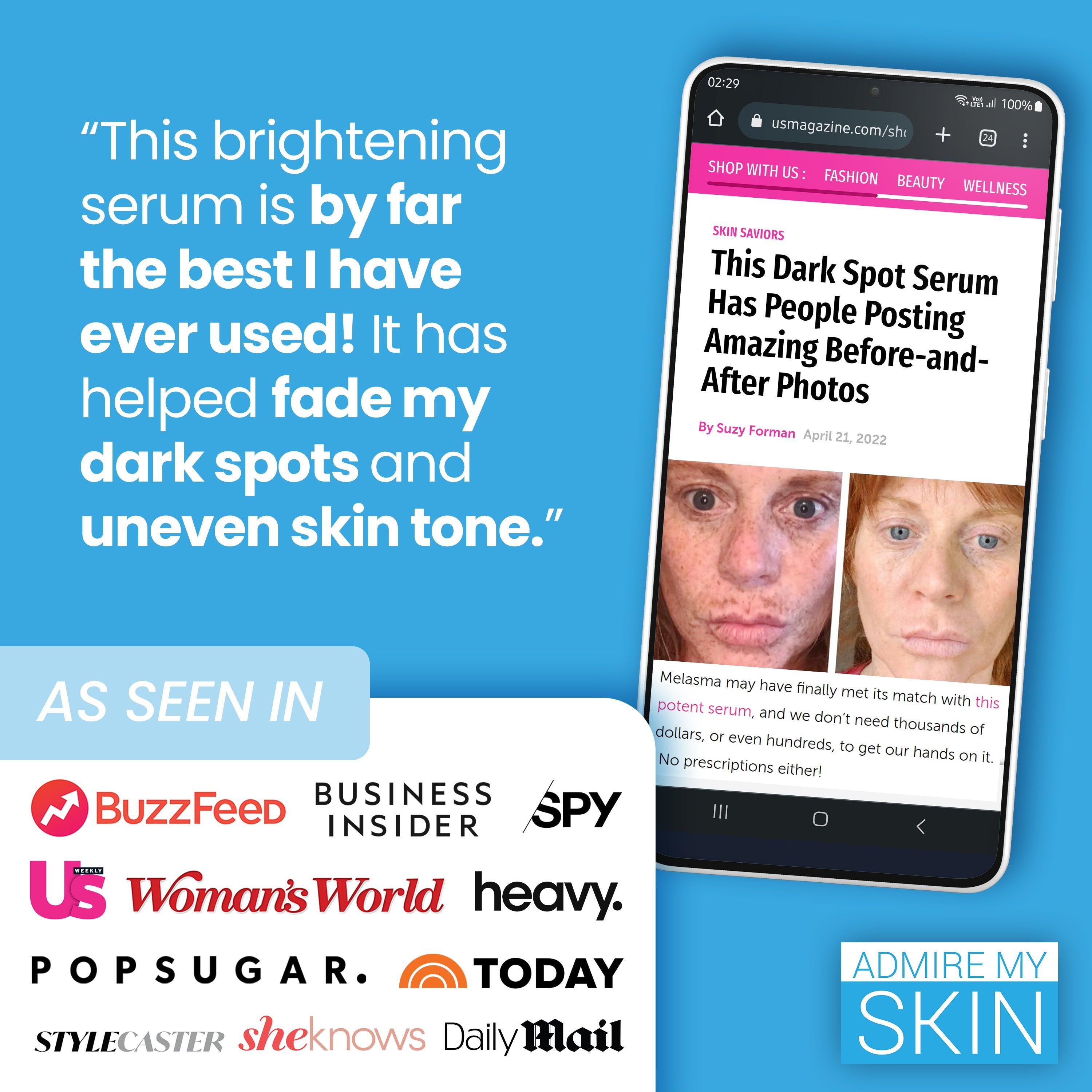 Ultrawirksames aufhellendes Serum gegen dunkle Flecken und ungleichmäßigen Hautton – bewundern Sie meine Haut